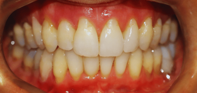 After - Merrowpark  Dental