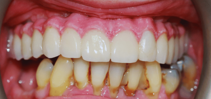 After - Merrowpark  Dental