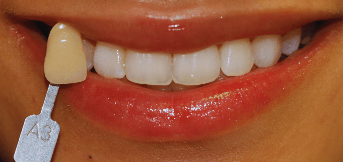 After - Merrowpark  Dental