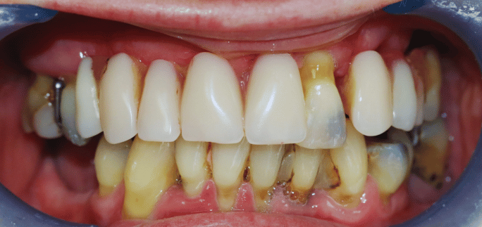 Before - Merrow Park Dental