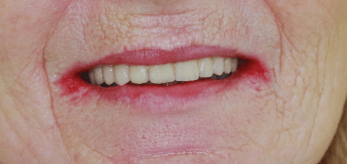 After - Merrowpark  Dental
