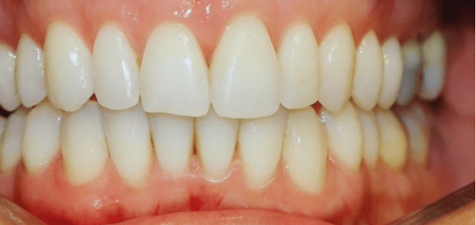 After - Merrowpark  Dental