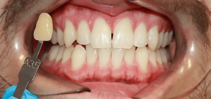 After - Merrowpark  Dental