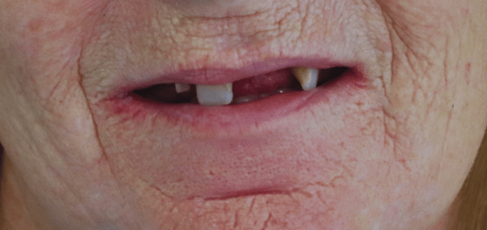 Before - Merrow Park Dental