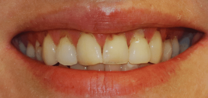 Before - Merrow Park Dental