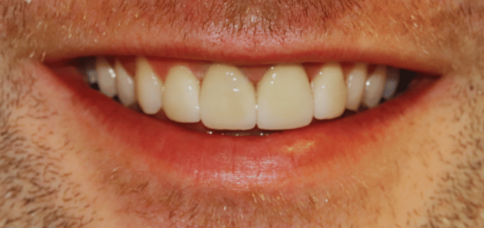 After - Merrowpark  Dental