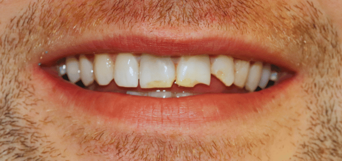 Before - Merrow Park Dental