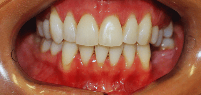 After - Merrowpark  Dental